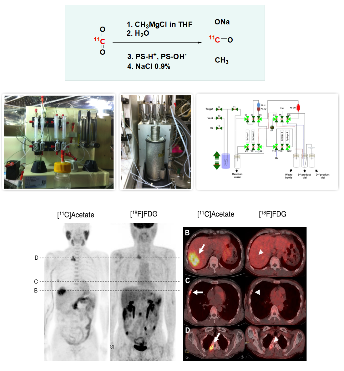 Development of optimized synthetic module for routine [11C]acetate production