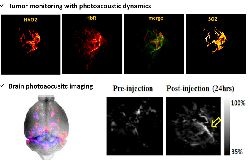 Multiscale and functional photoacoustic imaging